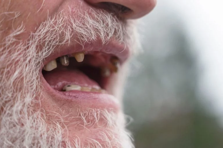 Ruttna Tänder – Drömmarnas Betydelse Och Symbolik 1